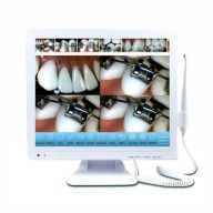   MLG M-978 Plus 17" érintőképernyős monitor + 6 LED-es 13.0 megapixeles orálkamera